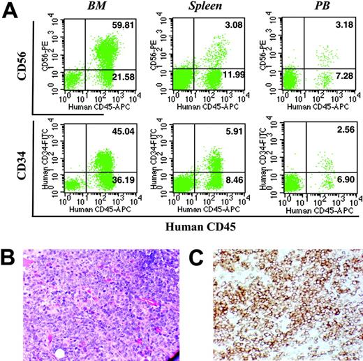 Figure 5. Analysis of hematopoietic tissues obtained from NOD/SCID mice receiving transplants of CD34+ cells from patient IM-4. (A) Representative flow cytometric analysis of BM (left column), spleen (middle column), and PB (right column) from mice that received transplants of PB CD34+ cells isolated from patient IM-4. Cells were analyzed by flow cytometry at 12 weeks after transplantation. (B) May-Grunwald-Giemsa staining (× 200) and (C) anti-CD34 immunochemical staining (× 200) of a section of tibia from the mouse that received a transplant of cells isolated from patient IM-4.