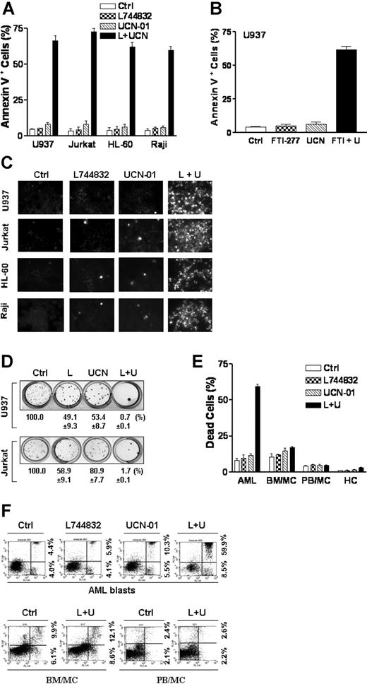 Figure 1. Coadministration of UCN-01 and farnesyltransferase inhibitors dramatically induces apoptosis and loss of clonogenicity in human leukemia cells. (A) U937, Jurkat, HL-60, and Raji cells were exposed for 18 hours to 10 μM L744832 (L) with or without UCN-01 (UCN or U, U937, and HL-60, 100 nM; Jurkat and Raji, 150 nM), respectively, after which the percentage of cells exhibiting annexin V positivity was determined by annexin V-FITC/PI staining and flow cytometry as described in “Materials and methods.” (B) U937 cells were exposed to 20 μM FTI-277 with or without 100 nM UCN-01 for 18 hours, after which the percentage of apoptotic cells was determined as described above. (C) U937, Jurkat, HL-60, and Raji cells were treated as in panel A, after which TUNEL staining was performed to document apoptosis. Original microscope magnification, × 300. The results of a representative experiment are shown; an additional study yielded equivalent results. (D) U937 and Jurkat cells were treated as in panel A, after which cells were washed free of drug and plated in soft agar as described in the text. After 12 days of incubation, colonies (more than 50 cells) were scored and colony formation for each condition expressed relative to untreated control cells. (E-F) Blasts from 3 patients with acute myeloid leukemia (AML; FAB classification M2) were isolated as described in “Materials and methods.” Mononuclear cells were isolated from the bone marrow (BM/MC) and peripheral blood (PB/MC) of patients with nonmalignant, nonmyeloid hematopoietic disorders or healthy volunteers, respectively, as described in “Materials and methods.” Primary rodent hepatocytes (HC) were isolated as described in “Materials and methods.” Cells were treated with 10 μM L744832 with or without 150 nM UCN-01 for 18 hours (AML, BM/MC, and PB/MC) or 10 μM L744832 with or without 100 nM UCN-01 for 24 hours (HC), respectively, after which the percentage of dead cells (E) was determined by evaluating Wright-Giemsa-stained (AML, BM/MC, and PB/MC) or Hoechst 33342-stained (HC) cytospin preparations. Alternatively, the percentage of annexin V-positive cells in AML blast samples (F, upper panels) and BM/MC and PB/MC (F, lower panels) was assessed by flow cytometry. The results of representative experiments are shown; additional studies yielded equivalent results. For panels A, B, D, and E, results represent the means ± SD for 3 separate experiments performed in triplicate.
