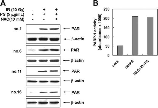Figure 6. PARP-1 activation induced by combination treatment of ionizing radiation with phytosphingosine is independent from ROS generation. (A) Radiation-resistant cells were treated with 10 Gy of γ-radiation alone, 5 μg/mL of phytosphingosine alone, or combination of γ-radiation (10 Gy) and phytosphingosine (5 μg/mL) in the presence or absence of 10 mM NAC. After 3 hours, cell lysates were subjected to Western blot analysis with anti-PAR and β-actin antibodies. The data represent a typical experiment conducted at least 3 times with similar results. (B) Clone no. 6 was treated with 10 Gy of γ-radiation alone, 5 μg/mL of phytosphingosine alone, or combination of γ-radiation (10 Gy) and phytosphingosine (5 μg/mL) in the presence or absence of 10 mM NAC. After 3 hours, PARP enzyme activity was measured using a commercial kit under guidance of manufacturer (see “Materials and methods”).