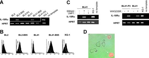 Figure 1. EBNA2 induces IL-18Rα expression in BL cells. (A) RT-PCR for IL-18Rα and the housekeeping gene, HPRT, in BL2, BL2-B95, BL2-P3, BL41, BL41-B95, BL41-P3, and KG-1 cells. (B) Flow cytometric analysis of IL-18Rα expression in BL2, BL2-B95, BL41, BL41-B95, and KG-1 cells. Cells were reacted with a mouse monoclonal antibody to IL-18Rα (filled histogram) or an isotype-matched control antibody (open histogram), followed by an FITC-labeled secondary antibody. (C) RT-PCR for IL-18Rα and HPRT in BL41 and BL41-P3 cells transfected with expression plasmids for EBNA2, LMP1, or the EBNA2-mutant WW323SR, as indicated. (D) BL2 cells, transiently transfected with an expression plasmid for EBNA2, were reacted 48 hours after transfection with a phycoerythrin-labeled mouse monoclonal antibody to IL-18Rα. Micrograph shows phase contrast and red fluorescence.