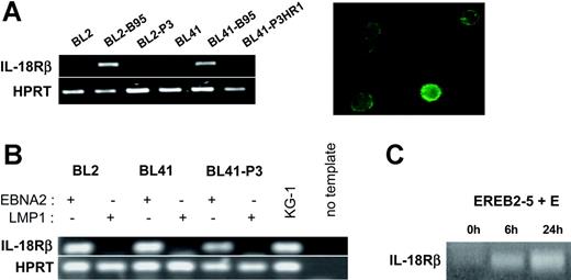 Figure 3. EBNA2 induces IL-18Rβ expression. (A) (Left) RT-PCR for IL-18Rβ and the housekeeping gene, HPRT, in BL2, BL2-B95, BL2-P3, BL41, BL41-B95, and BL41-P3HR1 cells. (Right) Green fluorescence micrograph of BL41-B95 cells, reacted with a goat polyclonal antibody to IL-18Rβ, followed by biotinylated antibodies to goat IgG and FITC-coupled streptavidin. (B) RT-PCR for IL-18Rβ and HPRT in BL2, BL41, and BL41-P3 cells transfected with expression plasmids for EBNA2 or LMP1, as indicated. (C) RT-PCR for IL-18Rβ in EREB2-5 cells treated with estrogen (E) for the indicated times.