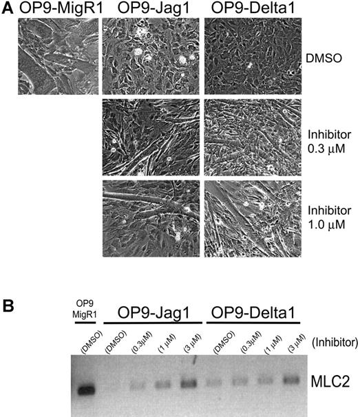 Figure 3. Comparison of Notch signals transmitted to C2C12 myoblasts from OP9-Jagged1 and OP9-Delta1. (A) Differentiation of C2C12 myoblast cells after 7 days coculture on OP9-MigR1, OP9-Jagged1, or OP9-Delta1 in the presence of carrier alone (0.1% DMSO) or increasing concentrations of γ-secretase inhibitor X. (B) RT-PCR analysis for expression of a myotube differentiation marker, MLC2, in C2C12 myoblasts shown in panel A. Total RNA extracted from a single well was reverse transcribed and normalized by TaqMan PCR for HPRT.