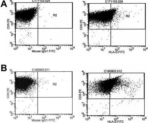 Figure 1. Cell surface expression of HLA-G in 2 cases of B-CLL. B-CLL cells were subjected to dual-color flow cytometry using a CD5-specific antibody and the HLA-G-specific antibody MEM/G9 (right column) or the respective isotype control (left column). (A) Low HLA-G expression. (B) High HLA-G expression.