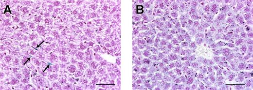 Figure 6. Hepatic iron staining. Perl Prussian blue stain of liver sections from a tumor-free mouse (A) and a hepcidin-secreting tumor mouse (B) on a high-iron diet. Unlike in tumor-free mice where spindle-shaped Kupffer cells (arrows) are the most prominent blue-staining cells, in mice with hepcidin-secreting tumors there is diffuse blue staining of the hepatocytes, showing that the increased hepatic iron is within hepatocytes. Scale bars represent 50 μm.