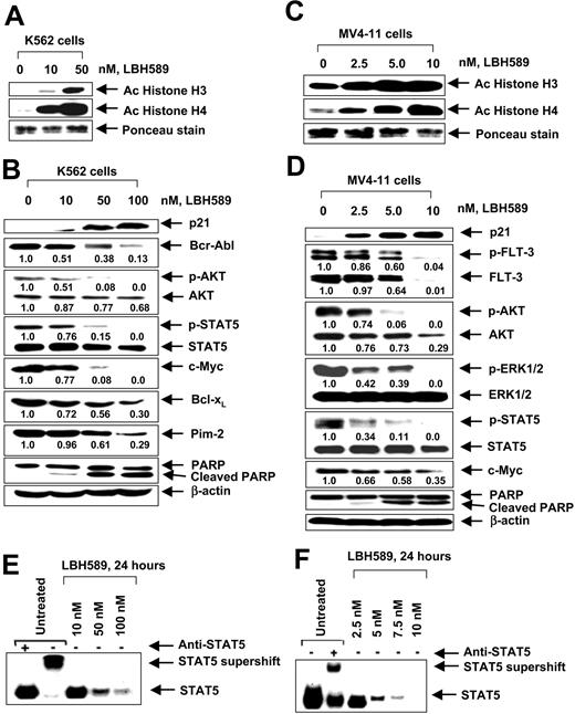 Figure 2. LBH589 induces hyper-acetylation of histones H3 and H4, increases p21, but depletes Bcr-Abl in K562 and p-FLT-3 and FLT-3 in MV4-11 cells. Cells were treated with indicated concentrations of LBH589 for 24 hours. After this, histones were isolated and Western blot analyses of acetylated histones H3 and H4 were performed in K562 cells (A) and MV4-11 cells (C). Ponceau staining served as the loading control. Western blot analyses of p21, Bcr-Abl, p-AKT, AKT, p-STAT5, STAT5, c-Myc, Bcl-xL, Pim-2, and PARP were performed on the cell lysates from K562 cells (B), and Western blot analyses of p21, p-FLT-3, FLT-3, p-AKT, AKT, p-ERK1/2, ERK1/2, p-STAT5, STAT5, c-Myc, and PARP were performed on the cell lysates from MV4-11 cells (D). The levels of β-actin served as the loading control. LBH589 inhibits DNA binding activity of STAT5 in K562 and MV4-11 cells. Following treatment of K562 (E) or MV4-11 cells (F) with the indicated concentrations of LBH589 for 24 hours, nuclear extracts were tested for the DNA binding activity of STAT5 by EMSA. For supershift analysis, the nuclear extracts were treated with anti-STAT5 antibody before the addition of the poly(dI-dC) and the labeled DNA probe (see “Materials and methods”).