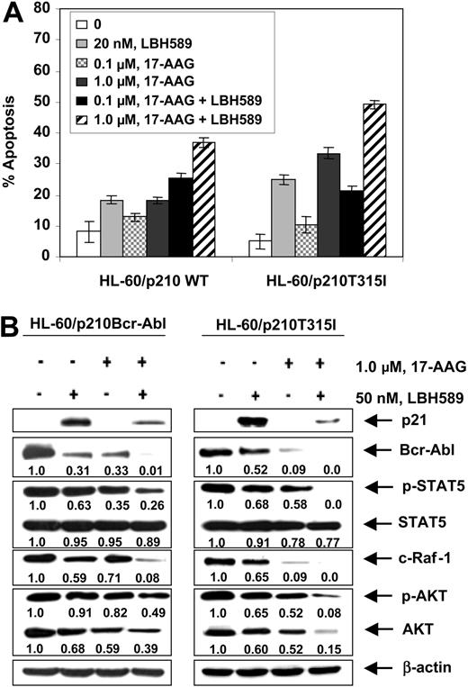 Figure 5. Cotreatment with LBH589 and 17-AAG induces more apoptosis of HL-60 cells with the wild-type p210Bcr-Abl or mutant p210T315I Bcr-Abl expressing leukemia cells. (A) HL-60/p210Bcr-Abl and HL-60/p210T315I cells were treated with the indicated concentrations of LBH589 and/or 17-AAG for 48 hours. Following this, the percentage of annexin-V-stained apoptotic cells was determined by flow cytometry. (B) Following treatment with 50 nM of LBH589 and/or 1000 nM 17-AAG for 24 hours, Western blot analyses of p21, Bcr-Abl, p-STAT5, STAT5, c-Raf-1, p-AKT, and AKT were performed in the cell lysates from wt p210Bcr-Abl or its mutant HL60/p210T315I expressing leukemia cells. The levels of β-actin served as the loading control.