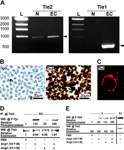 Figure 4. Expression and activation of Tie2 receptors in HUVECs and neutrophils. Tie2 mRNA expression in neutrophil (N) was revealed by RT-PCR, HUVEC (EC) mRNA was used as a positive control, and base pairs DNA ladder (L) was used as the molecular-weight standard. In contrast, Tie1 was present in HUVECs but not in neutrophils (A). Tie2 expression in neutrophils was confirmed at the protein level by immunocytochemistry, using anti-hTie2 IgG, and normal IgG was used as negative control (B). Tie2 protein was located at the cytoplasmic membrane of neutrophils as demonstrated by confocal microscopy (C). HUVECs were treated with either Ang1, Ang2, or Ang1 and Ang2 (10–9 M; 7.5 minutes). Tie2 proteins were first immunoprecipitated (IP) with anti-hTie2 IgG and Tie2 phosphorylation was analyzed by immunoblotting using antiphosphotyrosine IgG (4G10 clone). WB indicates Western blot. Membranes were subsequently stripped and the detection of Tie2 protein was performed to confirm equal protein loading (D). Neutrophils were treated with Ang1, Ang2, or Ang1 and Ang2 (10–9 M; 7.5 minutes). Cell lysates equivalent to 125 μg total proteins were loaded in each lane. Membranes were subsequently probed with antiphospho–hTie2 IgG (E).