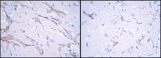 Effect of TF gene silencing on HCT116 tumor growth and angiogenesis. See the complete figure in the article beginning on page 1734.