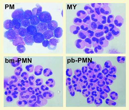 Granulocyte lineage cell populations used for microarray analysis. See the complete figure in the article beginning on page 1785.