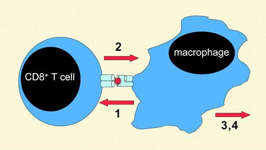 A theorized sequence of events in the development of hemophagocytic syndromes. In patients with hemophagocytic syndromes, antigen presentation (1) stimulates CD8+ T cells to secrete IFN-γ (2), which activates macrophages to produce multiple, toxic inflammatory mediators (3) and causes hemophagocytosis (4).