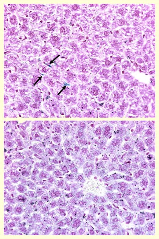 Hepatic iron staining. See the complete figure in the article beginning on page 1797.
