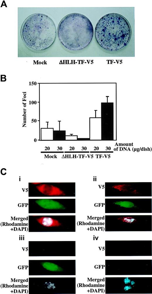 Figure 3. Focus-forming activity of TEL-FGFR3 and subcellular localization of TEL-FGFR3 chimeric protein in NIH/3T3 cells. (A) Representative results of the focus-forming assay in NIH/3T3 cells. NIH/3T3 cells were transfected with 30 μg of the indicated constructs and cultured for 2 weeks. Giemsa staining was performed for visualization of foci. (B) Comparison of the number of foci per dish. NIH/3T3 cells were transfected with 20 μg or 30 μg of the indicated DNA constructs. Colonies larger than 1 mm in diameter were counted. The results are expressed as the means plus SD of triplicate plates. Similar results were obtained in 2 independent experiments. (C) Subcellular localization of TEL-FGFR3 protein in NIH/3T3 cells by immunofluorescence staining. NIH/3T3 cells were transfected with (i) TF-V5, (ii) ΔHLH-TF-V5, or (iii) empty vector (mock), and (iv) nontransfected NIH/3T3 cells. Cells were cultured on microscope slides for 48 hours, fixed, and then subjected to permeabilization and indirect staining, as described in “Materials and methods.” DAPI was used as a nuclear counterstain. Expression of V5-associated protein derived from the EF-1 α promoter of TF-V5, ΔHLH-TF-V5, or mock and GFP-zeocin fusion protein derived from the independent cytomegalovirus (CMV) promoter in the same vectors was analyzed with fluorescence microscopy using the red (rhodamine), green (GFP), and blue (DAPI) channels. Images were captured with a CCD camera attached to a Nikon Eclipse E800 microscope with a Nikon Plan Apo 100×/1.40 oil objective lens (Nikon), and cropped and merged in Leica QFISH software (original magnification × 1000).