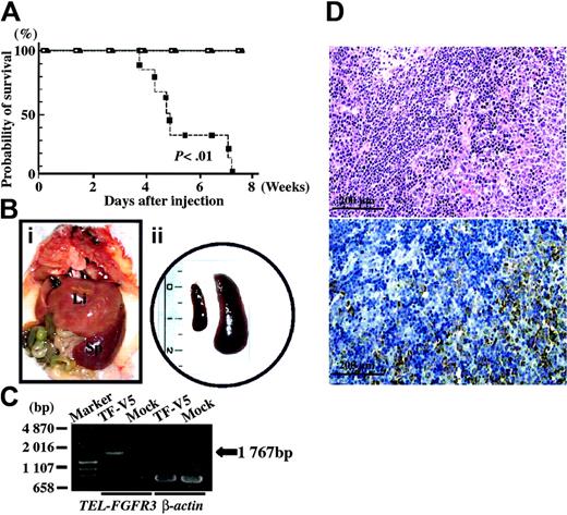 Figure 7. In vivo leukemogenic potential of TEL-FGFR3–transfected Ba/F3 cells. (A) Kaplan-Meier survival curves of BALB/c mice that had been injected with clonal populations of TF-V5– (▪), mock- (□), or ΔHLH-TF-V5–transfected Ba/F3 cells (▴). (Bi) Macroscopic view of the abdominal organs of a mouse that had been injected with TF-V5–transfected Ba/F3 cells. The terminally sick mouse was humanely killed 8 weeks after injection; Li indicates liver; Sp, spleen. (ii) Whole spleen specimens isolated from a mouse that had been injected with TF-V5–transfected Ba/F3 cells (right) and a mouse that had been injected with mock-transfected Ba/F3 cells (left). The mice were humanely killed 8 weeks after injection. Scale is in centimeters. (C) RT-PCR for TEL-FGFR3 using RNA that had been extracted from the spleens of mice injected with TF-V5–transfected Ba/F3 cells or mock-transfected Ba/F3 cells. RT-PCR for β-actin was performed as a positive control. (D) Histopathology of the spleen of a mouse that had been injected with TF-V5–transfected Ba/F3 cells. The same paraffin sections are shown. Photographs are taken on a light microscope (BHT-321; Olympus, Tokyo, Japan) with an Olympus NC SPlan 100×/1.40 dry objective lens (Olympus). (i) Hematoxylin and eosin staining. Infiltration of a massive number of leukemia cells is observed. (ii) Staining with anti-V5 antibody. Infiltration of leukemia cells is observed. Normal residual lesions in the spleen were not stained. Similar results were obtained in 3 experiments using 3 independent monoclonal transfectants.