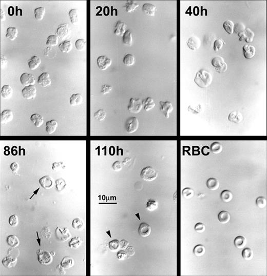 Figure 3. Morphological changes in differential interference contrast microscopy of cultured nascent reticulocytes. Aliquots of cultured nascent reticulocytes were concentrated by centrifugation, and wet mount preparations in tissue culture medium were prepared at the times shown. Biconcave cells are shown as arrows in the 86-hour cells and as arrowheads in the 110-hour cells. RBC is a wet mount preparation of blood erythrocytes from a normal mouse. Magnification, × 390.