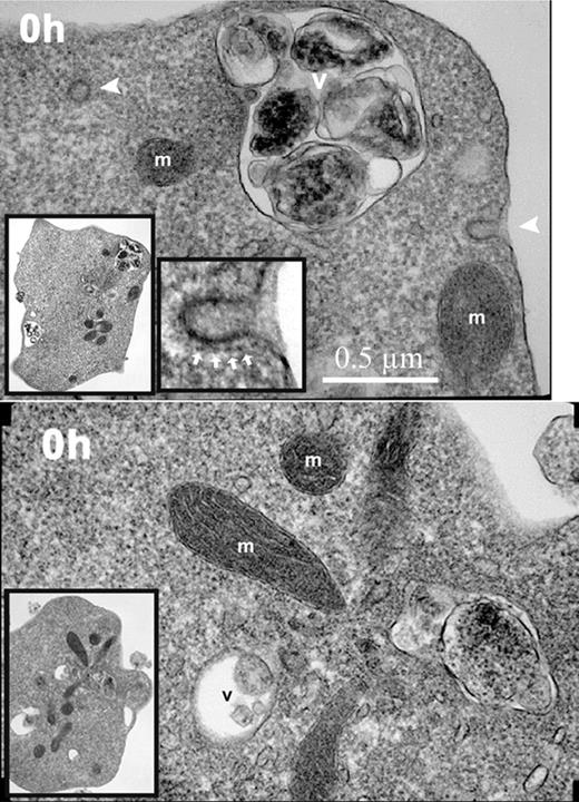 Figure 4. Electron micrographs of nascent (0-hour) reticulocytes. Nascent reticulocytes were placed in culture medium and incubated for 15 minutes at 37°C prior to fixation and processing for transmission electron microscopy. Images of 2 reticulocytes demonstrating endocytic vesicles (arrowheads), mitochondria (m), and intracellular vacuoles (v). Inserted images in lower left corner of each panel show lower-power magnification of the same respective cells. Image in the lower center of the top panel shows a higher-power magnification of the coated pit in the upper right of the same reticulocyte. The clathrin coating the pit is shown by white arrows. Magnification, × 23 000.