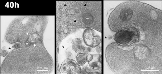 Figure 5. Electron micrographs of reticulocytes cultured for 40 hours. Images of reticulocytes demonstrating mitochondria (m) in various states of degradation: in close association with a vacuole (white arrowheads in left panel), with ballooning of the outer membrane (black arrowheads in center panel), and intact (right panel). Intracellular vacuoles (v) contain cellular debris, and the reticulocytes demonstrate exocytic activity (asterisks). Magnification: left, × 20 000; center, × 24 000; right, × 35 000.
