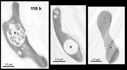 Figure 6. Electron micrographs of reticulocytes cultured for 110 hours. Images of reticulocytes showing large intracellular vacuoles (v) containing cellular debris (left panel) or without cellular debris (center panel). A biconcave cell (right panel) without autophagic vacuoles contains faint, residual intracellular membranes (arrowhead) that are filled with hemoglobin. Magnification: left, × 7200; center, × 7500; right, × 6800.