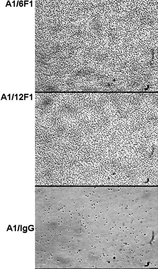 Figure 3. Interaction of flowing platelets with immobilized VWF-A1/12F1 and VWF-A1/6F1. Whole blood was perfused over surface coated with the VWF-A1 (150 μg/mL) mixed with 6F1, 12F1, or mouse IgG (200 μg/mL). After 2-minute perfusion, the coverslips were washed with TBS and several frames of attached platelets were recorded. The photomicrographs represent 3 separated assays.