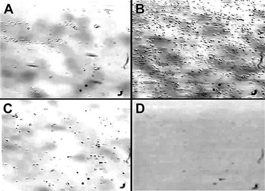 Figure 4. Interaction of flowing platelets with a collagen or A1/collagen surface. Plasma-free blood was perfused at a shear rate of 1500 s–1 over different coating substrates in the absence or presence of inhibitors. (A) Collagen surface, (B) A1/collagen surface, (C) A1/collagen surface, in the presence of antibody 6F1 (against the α2-I domain), and (D) A1/collagen surface, in the presence of antibody 6D1 (against GP Ibα). The photomicrographs depict the platelets tethered to the surface after 2 minutes of perfusion and represent 3 separate experiments with blood from different donors.