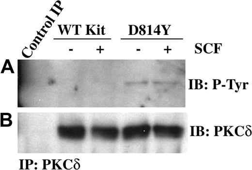Figure 2. PKCδ associated with membranes from IC2 cells expressing D814Y Kit is phosphorylated on tyrosine. IC2 cells expressing WT or D814Y Kit were stimulated with 100 ng/mL murine SCF for 15 minutes at room temperature prior to isolation of membranes. (A) Membrane protein (600 μg) from IC2 cells expressing WT or D814Y Kit was immunoprecipitated with an antibody specific for PKCδ, resolved by SDS-PAGE, transferred to immobilon-P, and immunoblotted with an antibody for phosphotyrosine. Membrane proteins immunoprecipitated with normal rabbit IgG were used as a negative control. (B) The immunoblots were subsequently stripped and reprobed with an antibody specific for PKCδ. These data are representative of results from 4 independent experiments. IB indicates immunoblot.