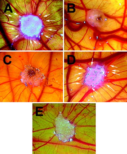 Figure 3. GAS6 inhibits VEGF-A165–mediated vascularization in CAM assay. CAMs were recorded at day 12 of incubation, 96 hours after the implant of a gelatin sponge soaked with VEGF-A165 (50 ng) (A), GAS6 (50 ng) (B), VEGF-A165 with GAS6 (20 ng) (C), or phosphate-buffered saline (E). Panel D shows the reverting effect of the presence Axl-Ig (200 ng) on the inhibitory effect of GAS6 (20 ng). Arrows in panels A and D indicate the new capillaries attracted by the sponges. Original magnification × 50. The picture is representative of 1 experiment of at least 4 performed. Images were processed by Image Proplus 4.0.