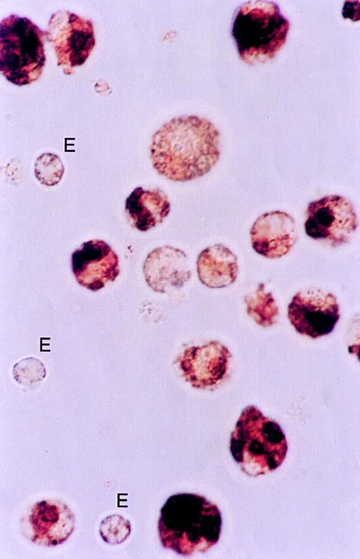 Figure 4. Histochemistry of Kupffer cells for the presence of peroxidase activity at 30 minutes after injection of vesicles. Cells were isolated as described in “Materials and methods.” Cytospins were fixed in acetone and stained with 3,3′-diaminobenzidine. The large quantities of stainable material in the Kupffer cells indicate the presence of hemoglobin. The endothelial cells (E) are slightly stained indicating the presence of endogenous peroxidase. Original objective magnification × 100. The procedure was repeated 2 times with very similar results.