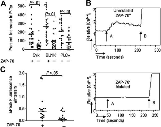 Figure 2. IgM-induced p72Syk, BLNK, and PLCγ phosphorylation and calcium mobilization in CLL B cells with or without ZAP-70. (A) IgM-induced phosphorylation of p72Syk (Syk), BLNK, and PLCγ in CLL B cells with or without ZAP-70. The bar size corresponds to the percent increase in phosphorylated proteins after anti-μ stimulation by CBA assay. (B) IgM-induced calcium mobilization in CLL B cells with or without ZAP-70. The relative mean fluorescence intensity in intracellular calcium is plotted as a function of time: arrow A indicates IgM stimulation; arrow B, ionomycin stimulation. (C) IgM-induced calcium fluorescence intensity increase in CLL B cells with or without ZAP-70. The bar size corresponds to the increase of fluorescence intensity value after anti-μ stimulation. + indicates CLL B cells with ZAP-70 expression; –, CLL B cells without ZAP-70 expression. The horizontal line drawn among the samples of each group represents the median increase in signal intensity for that group.