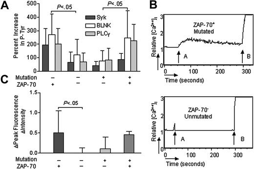 Figure 3. p72Syk, BLNK, and PLCγ phosphorylation and calcium mobilization in CLL B cells with discordant expression of Ig genes and ZAP-70. (A) IgM-induced phosphorylation of p72Syk (dark gray bars), BLNK (open bars), and PLCγ (light gray bars) in CLL B cells with discordant expression of Ig genes and ZAP-70. The bar size corresponds to the percent increase in phosphorylated proteins after anti-μ stimulation by CBA assay. (B) IgM-induced calcium mobilization in CLL B cells with discordant expression of Ig genes and ZAP-70. The relative mean fluorescence intensity in intracellular calcium is plotted as a function of time: arrow A indicates IgM stimulation; arrow B, ionomycin stimulation. (C) IgM ligation–induced calcium fluorescence intensity increase in CLL B cells with discordant expression of Ig genes and ZAP-70. The bar size corresponds to the increase of fluorescence intensity value after anti-μ stimulation. + indicates CLL B cells with mutated Ig genes or ZAP-70 expression; –, CLL B cells with unmutated Ig genes or without ZAP-70 expression. Error bars indicate mean ± SD.