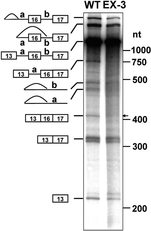 Figure 2. In vitro splicing of WT and EX-3 substrates. The WT and EX-3 mutation pre-mRNAs were synthesized and subjected to in vitro splicing reactions using HeLa nuclear extracts. The RNAs were resolved on a 4% polyacrylamide gel containing 8 M urea and visualized by autoradiography. The precursors, intermediates, and final products are indicated at left. The RNA molecular weight markers in nt are at right. The arrow indicates product with exon 16.