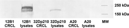Figure 4. Absence of BCR-ABL p210 protein in 12B1 or 32Dp210 CRCL. 12B1 or 32Dp210 tumor lysates and CRCL from each of the lysates were prepared and separated on SDS-PAGE, followed by transfer to nitrocellulose for Western blotting. Presence of p210 BCR-ABL protein was probed using an antibody for c-ABL. A20 tumor lysates and CRCL served as negative controls.