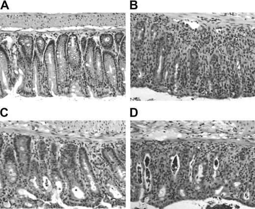 Figure 6. Minimal histologic damage in the large intestine 5 days after cotransfer of CD4+CD25+CD62L+ Treg cells. Lethally irradiated BALB/c hosts received TCD BM or TCD BM plus 500 000 CD4+CD25- T cells alone or together with 500 000 CD4+CD25+CD62L+ or CD4+CD25+CD62L- T cells. Animals (n = 3 each group) were killed 5 days later, and a piece of large bowel was processed for standard H/E histology. Representative sections are shown at 1:40 magnification for recipients of (A) TCD BM alone, (B) CD4+CD25- T cells, (C) CD4+CD25- plus CD4+CD25+CD62L+ T cells, and (D) CD4+CD25- plus CD4+CD25+CD62L- T cells.