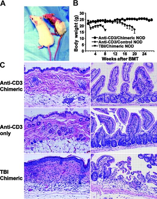 Figure 2. No signs of GVHD in the anti-CD3–conditioned chimeric recipients. (A) Representatives of GVHD-free recipients conditioned with anti-CD3 and GVHD recipients conditioned with TBI. (B) Body weight change of recipients over a follow-up period of 28 weeks after BMT. ⬡ indicates anti-CD3–conditioned chimeric NOD recipients; , NOD mice given anti-CD3–conditioning only; and ▾, TBI-conditioned chimeric NOD recipients. Values are mean ± SE of anti-CD3–conditioned chimeric recipients (n = 12), NOD mice given anti-CD3–conditioning only (n = 12), and TBI-conditioned chimeric recipients (n = 8). (C) Histology of skin and small intestine tissues of the anti-CD3–conditioned chimeric recipients (top row), NOD mice given anti-CD3–conditioning only (middle row), and TBI-conditioned chimeric recipients 50 days after BMT (bottom row). One representative of 4 recipients examined in each group is shown.