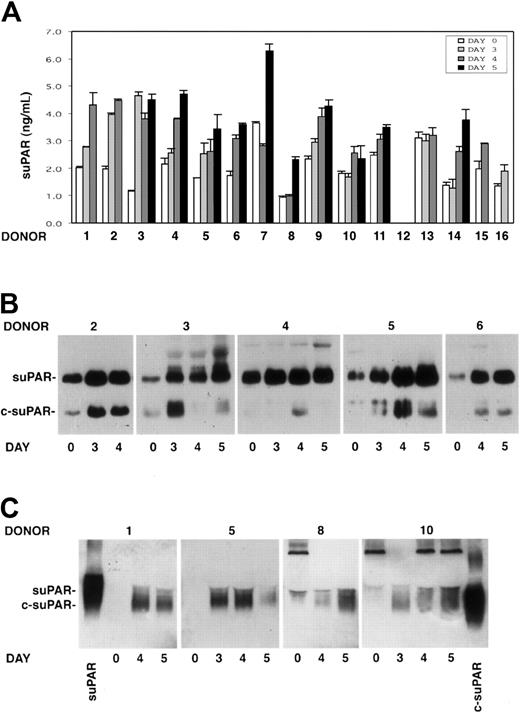 Figure 3. Intact and cleaved forms of soluble uPAR increase in sera of G-CSF–treated donors. Cleaved forms of soluble uPAR are also released by donor PBMNCs in vitro. (A) ELISA measurement of soluble uPAR (suPAR) in the sera of 15 donors, collected before (day 0) or at different time points (days 3-5) of G-CSF administration. Error bars are not shown when graphically too small. (B) Immunoprecipitation and immunoblotting of sera obtained from 5 donors before (day 0) and at different time points (days 3-5) of G-CSF administration. Samples were immunoprecipitated with biotinylated monoclonal antibodies (mAbs R2 and R3), previously immobilized on streptavidin-coated beads, to detect intact (suPAR) and cleaved (c-suPAR) soluble forms of uPAR. Adsorbed proteins were deglycosylated by peptide-N-glycosidase, eluted, and analyzed by immunoblotting with a rabbit anti-uPAR polyclonal antibody. (C) Western blot analysis with an anti-uPAR polyclonal antibody of conditioned media obtained after serum-free short-term cultures of PBMNCs collected before (day 0) or at different time points (days 3-5) of G-CSF stimulation from 4 representative donors. The first and the last lanes of the panel were loaded with a positive control of intact soluble uPAR (suPAR) and a cleaved form of suPAR, devoid of D1 (c-suPAR), respectively.