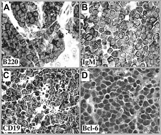 Figure 1. Immunophenotype of mouse BLL. Shown are representative tissue sections of lymphomas after immunostaining with antibody to B220 (A), IgM (B), CD19 (C), and Bcl-6 (D), followed by horseradish peroxidase (HRP)–conjugated secondary antibody (1:200 dilution). The images were captured by a Zeiss Axiophot microscope equipped with a DC330E CCD camera (Dage MTI, Michigan City, IN) and Scion Image software (Scion, Frederick, MD). The original magnification of the objective lens was 40 ×, and its numerical aperture was 0.75. Scion Image software (Scion, Frederick, MD) was used to capture images.