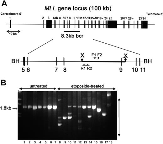 Figure 2. IPCR analysis to detect etoposide-induced rearrangements initiating within the MLL bcr. (A) Schematic representation of the MLL gene locus on chromosome band 11q23. The 8.3-kb MLL bcr, flanked by BamHI sites, includes exons 5 to 11 and intervening introns. XbaI sites are 2.6 kb apart within the MLL bcr. Genomic DNA was digested with XbaI and circularized. Nested PCR reactions were carried out with F1-R1 primer pair, followed by F2-R2 primer pair. BH (BamH1); X (XbaI); F1, F2, R1, R2 are primers used for PCR (see “Materials and methods”). (B) Representative IPCR products. Lanes 1-7: untreated controls that give the expected 1.8-kb germ-line product. Lanes 8-18: etoposide-treated samples that all give alternative products representing possible rearrangements of MLL. Pretreatment of samples shown in lanes 8 to 18 with PvuII eliminated some or all detectable germ-line product to facilitate isolation of individual alternative sized products. Lanes 8-12: multiple independent CD34+ cell samples (long recovery) with all germ-line products eliminated by PvuII in lanes 8-9; lane 13: TF-1 (short recovery); lane 14: WS1 (short recovery); lanes 15-16: M059K (short recovery); lane 17: M059J (short recovery); and lane 18: cord blood mononuclear cells (short recovery). Parallel experiments in multiple hematologic and other adherent cell lines gave similar IPCR results (B), but individual repair clones have not been fully characterized.