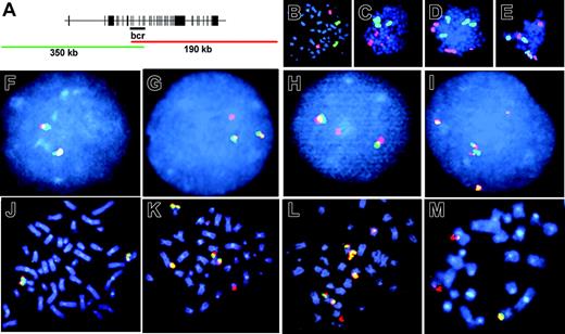 Figure 5. Fluorescence in situ hybridization to visualize etoposide-induced chr11 rearrangements in cells after long recovery period. (A) Schematic overlap between fluorescent probes of 11q23 locus–specific identifier (LSI). Intact 11q23 is seen as yellow signal (overlap of green and red). Aberration of 11q23 is seen as separation of probes into independent green and red signals. (B-E) Whole chromosome painting with chr 11–Cy3 (red) and chr 4–FITC (green). (B) Untreated CD34+ control. (C-E) Representative metaphase spreads that contain chr 11 aberrations. (F-I) LSI of chromosome band 11q23 in interphase and metaphase cells. (F,J) Untreated CD34+ control. (G-H) Representative split signals observed in 59 of 850 etoposide-treated and analyzed cells. (I, K-M) Representative complex rearrangements observed in 46 of 850 etoposide-treated and analyzed cells. Images were viewed at 600×, 1.4 aperture, with Immersol oil immersion (Zeiss, Oberkochen, Germany).