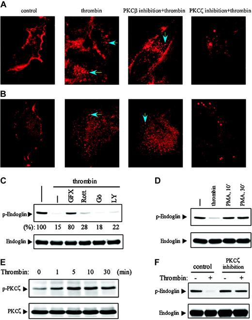 Figure 5. Thrombin induces a PKC-ζ–dependent internalization of endoglin and TβRII in ECs. (A-B) HUVECs grown on glass coverslips were left untreated (control) or pretreated with myristoylated PKC-β or PKC-ζ peptide inhibitors, then stimulated for 30 minutes with thrombin (3 U/mL), washed twice, and fixed. Endoglin (A) and TβRII (B) were viewed (10 × 100) by staining the fixed cells with antibodies against L-endoglin (SN6h) or TβRII (C-16). Arrows indicate the internalized endoglin or TβRII. (C) HUVECs were left untreated (–) or pretreated for 30 minutes with GF109203X (GFX; 15 μM), rottlerin (Rott; 10 μM), Gö6976 (Gö; 300 nM), or LY294002 (LY; 20 μM), then stimulated with thrombin (3 U/mL) for 30 minutes. (D) HUVECs were stimulated with thrombin (3 U/mL) for 30 minutes or phorbol 12-myristate 13-acetate (PMA; 100 nM) for 10 or 30 minutes. Lysates were subjected to immunoblotting with the antibody against the serine-phosphorylated endoglin as described in Figures 1 and 2. (E) HUVECs were stimulated with thrombin (3 U/mL) for the indicated time periods. Lysates were immunoblotted with an antibody against phospho–PKC-ζ/λ (Thr-410/403). (F) HUVECs were left untreated (control) or pretreated with a myristoylated PKC-ζ peptide inhibitor for 30 minutes, then stimulated with thrombin (3 U/mL) for 30 minutes. The serine phosphorylation of endoglin was determined as described in Figures 1 and 2. Results shown are representative of 3 independent experiments.