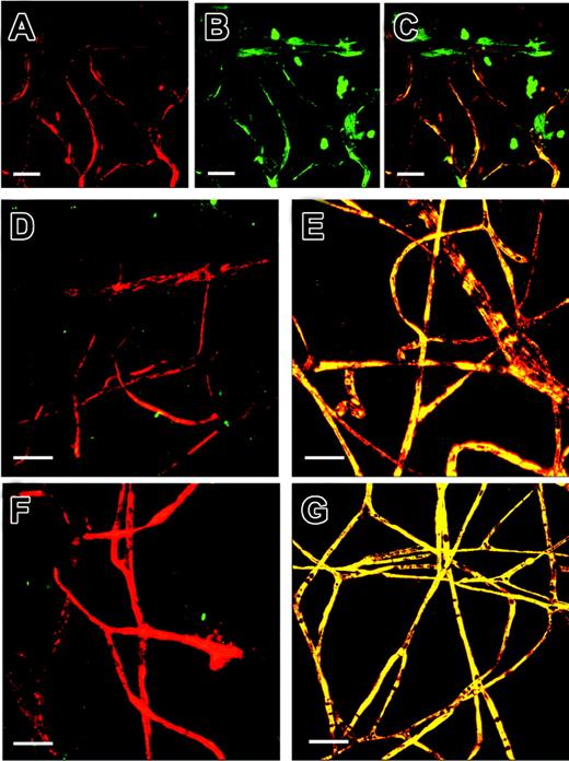 Figure 2. WT retinal neovascularization. C57BL/6.gfp chimeric mice underwent the retinal ischemia model followed by perfusion with TRITC before eye enucleation and confocal imaging of the retinas. Panel A is the red channel alone. Panel B is the green channel alone. Panel C is the merged image of the red and green channels. Yellow areas are colocalization of donor-derived gfp cells and TRITC-perfused patent vessels. Note: All further panels in each figure are from red and green channel merged images unless noted. Panels D and F are contralateral untreated control eyes and E and G are experimental eyes from the same respective mice. Original magnification × 60; size bar about 10 μm.