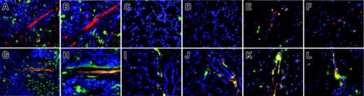 Figure 6. Chronic vascular injury in eNOS. gfp chimeras induces widespread hemangioblast activity from adult HSCs. Spleen (A-B,G-H), thymus (C-D,I-J), and brain (E-F,K-L) were harvested from TRITC-perfused animals and 10-μm cryosections were prepared and mounted with Vectashield plus DAPI. iNOS.gfp (A-F) and eNOS.gfp (G-L) chimeras were examined by fluorescence microscopy. Donor gfp HSC-derived cells are green and the TRITC perfusant is red. Original magnification × 40 for panels A and G. All remaining panels are original magnification × 64.