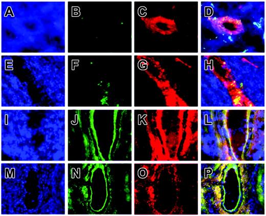 Figure 7. MECA-32+, gfp+, HSC-derived endothelial cells in eNOS.gfp spleens. Splenic cryosections were prepared from C57BL/6.gfp (A-D), iNOS.gfp (E-H), and eNOS.gfp (I-P) chimeras. Sections were stained with anti-MECA-32 antibody and a Texas red-conjugated secondary antibody to delineate vascular endothelium. Sections were mounted with DAPI (A,E,I,M) to delineate nuclei with blue fluorescence, examined for gfp expression (B,F,J,N) via green fluorescence, or MECA-32 staining (C,G,K,O) via red fluorescence. (D,H,L,P) Merged images of the DAPI, gfp, and MECA-32 Texas red stains. Original magnifications × 64 (A-L) and × 32 (M-P).