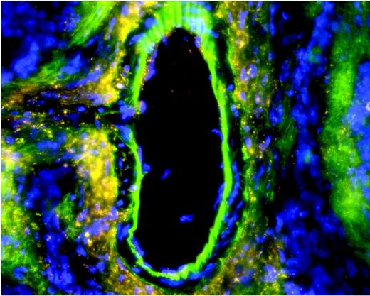 Chronic vascular injury in eNOS gfp chimeras induces widespread hemangioblast activity from adult HSCs. See the complete figure in the article beginning on page 1916.