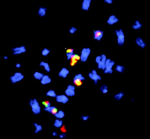 Fluorescence in situ hybridization to visualize etoposide-induced chr11 rearrangements in cells after long recovery period. See the complete figure in the article beginning on page 2124.