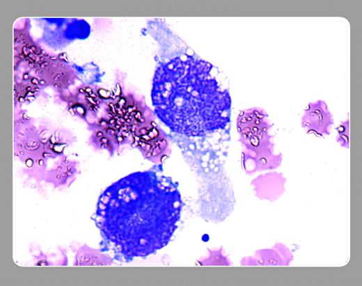 Peter Maslak, Memorial Sloan-Kettering Cancer Center