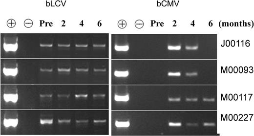 Figure 2. Both bLCV and bCMV were present in all 4 animals during immune reconstitution. Serum was obtained before transplantation (“Pre”) and at approximately 2, 4, and 6 months after transplantation and were subjected to PCR, as described in “Materials and methods.” DNA extracted from bCMV lysate (derived from bCMV-infected MRC5 cells) was used as a positive control (+) for bCMV and as a negative control (-) for bLCV. DNA extracted from bLCV-transformed B lymphoblastoid cells was used as a positive control for bLCV and a negative control for bCMV. The fact that bLCV was detected in all 4 animals before transplantation is consistent with the observation of Dittmer et al (D. Dittmer, unpublished information, April 2004, with permission), who detected bLCV in the blood of 71 of 90 normal seropositive baboons. The fact that bCMV was undetectable before transplantation and detectable at 2 to 4 months after transplantation is consistent with the expected viral reactivation, leading to increased viral load early after transplantation.