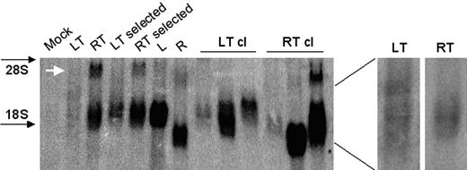 Figure 2. Northern blot analysis of cells transduced by HIV-based (LT) and MLV-based (RT) promoter traps and control MLV-based (R) and HIV-based (L) vectors. Analysis was performed on 293T cells transduced with the indicated vectors, before or after puromycin selection, and in representative puromycin-resistant clones. Cells were transduced with matched vector doses yielding multicopy integration (average of 10) per cell in the unselected cells (LT and RT), and average single-copy integration in the selected populations (LT/RT selected), clones (LT/RT cl), and in cells transduced by control vectors (L, R). The white arrow indicates the LTR-driven antisense transcript of RT. Note that this transcript is expressed to low extent because of the SIN modification and is better detected in cells containing high numbers of vector integrants. The LT and RT lanes are shown enlarged on the right and after a shorter exposure time for the RT lane to better compare the hybridization pattern.