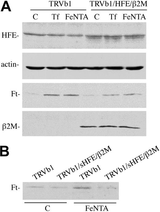 Figure 2. HFE decreases intracellular ferritin levels in TRVb1 cells. (A) HFE expression. TRVb1 or TRVb1/HFE/β2M cells were left untreated or incubated with 3 mg/mL diferric Tf or 150 μM Fe-NTA for 24 hours prior to harvesting. Cell lysates (45 μg total protein) were subjected to SDS–polyacrylamide gel electrophoresis (PAGE), transferred to nitrocellulose, and probed with antibodies to TfR1, actin, HFE (no. 137), ferritin (Ft), or β2M. The no. 137 rabbit anti-HFE serum gives a nonspecific band just above the HFE doublet. Actin was used as a loading control. (B) sHFE treatment. TRVb1 cells were treated with 0.5 μM sHFE overnight in the presence (Fe-NTA) or absence (C) of 150 μM Fe-NTA. Cell lysates were then prepared and used for immunodetection of ferritin levels as described for panel A. These experiments were repeated 3 times using 3 different clones for each cell line with similar results.