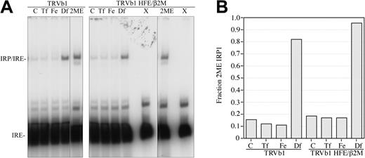 Figure 3. HFE expression in TRVb1 cells increases binding of IRP to IRE. Cells were left untreated (C) or incubated with 1 mg/mL diferric Tf (Tf), 150 μM Fe-NTA (Fe), or 100 mM desferal (Df) for 16 to 24 hours prior to harvesting. (A) Gel shift assay. Cell lysates (10 μg total protein) were incubated with approximately 50 000 cpm of 32P-labeled RNA probe, and the reaction mixtures were resolved on 7% polyacrylamide (60:1 acrylamide/bis) gels. The lysates of cells treated with desferal were also mixed with incubation buffer containing 2-mercaptoethanol to measure maximal IRP binding in each cell line (2ME). A separate lane was loaded with probe alone as a control (X). Samples containing 2ME were run at the same time on a separate gel. Gels were exposed to x-ray film for the same period of time. (B) Quantitation of the bands in panel A. The radioactivity in each band was detected and quantitated on a PhosphorImager (Amersham, Piscataway, NJ) using IP Lab Gel 1.5 software. The amount of radioactivity in each band was normalized to the total IRP binding (2ME-treated extracts of Df-treated cells) in each cell line. This experiment was repeated once for each cell line with a similar result.