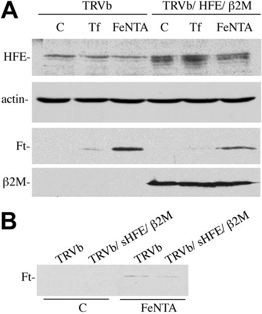 Figure 4. HFE lowers ferritin levels in TRVb cells. (A) HFE expression. TRVb or TRVb/HFE/β2M cells were left untreated (C) or incubated with 3 mg/mL diferric Tf or 150 mM Fe-NTA for 24 hours prior to harvesting. Cell lysates (30 μg total protein) were subjected to SDS-PAGE, transferred to nitrocellulose, and probed with antibodies to HFE (no. 137), actin, Ft, or β2M. The no. 137 rabbit anti-HFE serum gives a nonspecific band just above the HFE doublet. Actin was used as a loading control. (B) sHFE treatment. TRVb cells were treated with 0.5 μM sHFE overnight in presence (Fe-NTA) or absence (C) of 150 μM Fe-NTA. Cell lysates were then prepared and used for immunodetection of ferritin levels as described in panel A. This experiment was repeated 3 times using 3 different clones for each cell line with similar results.