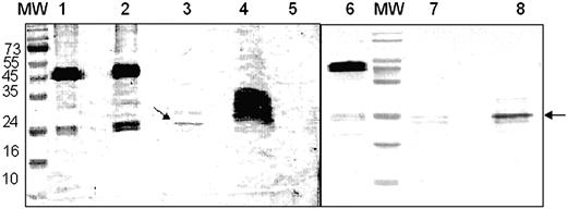 Figure 2. Binding of recombinant F2 and chymotryptic F2 fragments to glycophorin A in pull-down assays. Recombinant F2 was used in pull-down assays with glycophorin A before and after treatment with chymotrypsin. Recombinant F2 and chymotrypsin-treated F2 were incubated with glycophorin A to allow binding. F2 fragments bound to glycophorin A were precipitated using a mouse monoclonal antibody raised against glycophorin A and protein A-Sepharose. Bound F2 fragments were separated by SDS-PAGE and detected by Western blotting using rabbit sera raised against recombinant F2. MW indicates prestained molecular weight markers shown in kDa; lane 1, full-length recombinant F2 used for pull-down assays; lane 2, pull-down assay with recombinant F2 and glycophorin A; lane 3, pull-down assay with chymotrypsin-treated F2 (incomplete proteolysis) and glycophorin A; lane 4, chymotrypsin-treated F2 (incomplete proteolysis) used for pull-down assay; lane 5, control pull-down assay using recombinant F2 and BSA instead of glycophorin A; lane 6, full-length recombinant F2; lane 7, chymotrypsin-treated F2 (complete proteolysis); lane 8, pull-down assay with chymotrypsin-treated F2 (complete proteolysis) and glycophorin A.