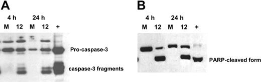 Figure 3. OSU03012 induces activation of intrinsic pathway of apoptosis as shown by caspase-3 and PARP cleavage. (A) OSU03012 induces activation of the intrinsic pathway of apoptosis. Protein lysates from cells treated for 4 and 24 hours with 10 μM OSU03012 were probed for caspase-3 by immunoblot. M indicates media; 12, 10 μM OSU0312. Positive control (+) is lysate from irradiated Jurkat cells. Data are representative of 8 patients. (B) Protein lysates from cells treated for 4 and 24 hours with 10 μM OSU03012 were probed for PARP by immunoblot (M indicates media; 12, 10 μM OSU0312). Positive control is lysate from irradiated Jurkat cells. Data are representative of 8 patients.